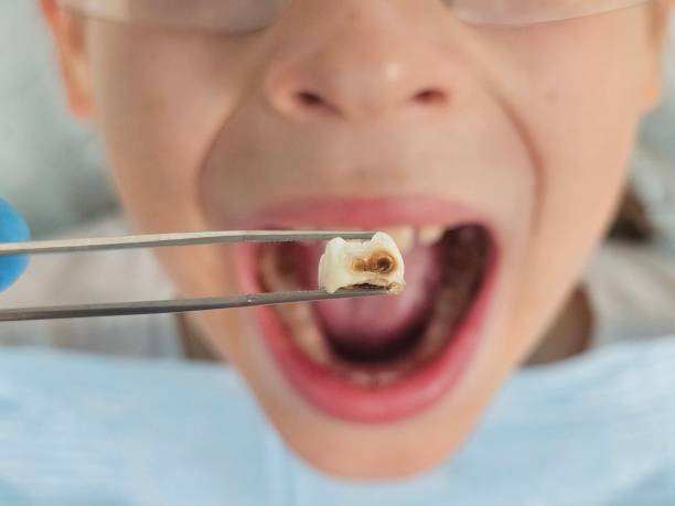 Best Tooth Pain Emergency Relief  in Cedar Hills, OR